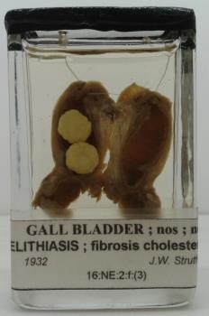 GALLBLADDER